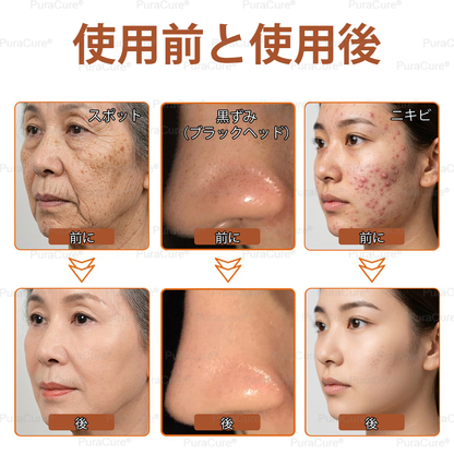 🧑‍⚕️PuraCure® 美白・スポットケアフェイスマスク【顔・ボディ兼用】天然由来成分配合で、シミ・そばかす・日焼けによるシミを長期間ケア✨