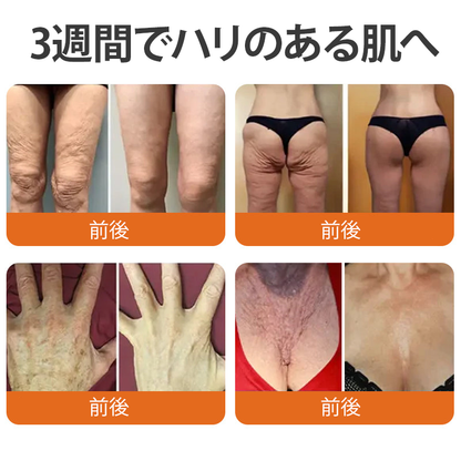 ✨PuraCure® ビーベノム リペア再生クリーム🔥天然由来のエイジングケアで肌を引き締め、ハリを与え、乾燥による小ジワを目立たなくします – 50mL