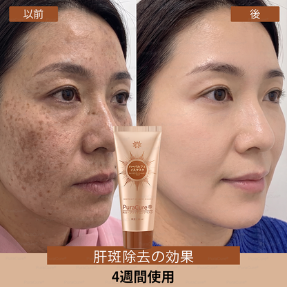 🧑‍⚕️PuraCure® 美白・スポットケアフェイスマスク【顔・ボディ兼用】天然由来成分配合で、シミ・そばかす・日焼けによるシミを長期間ケア✨