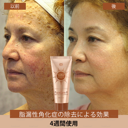 🧑‍⚕️PuraCure® 美白・スポットケアフェイスマスク【顔・ボディ兼用】天然由来成分配合で、シミ・そばかす・日焼けによるシミを長期間ケア✨