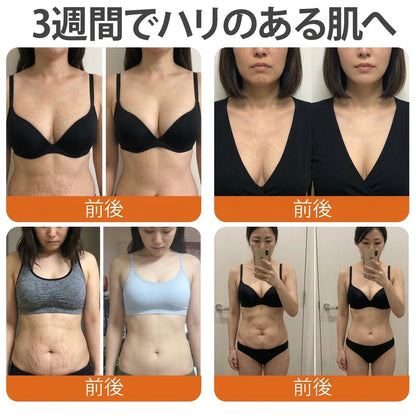 ✨PuraCure® ビーベノム リペア再生クリーム🔥天然由来のエイジングケアで肌を引き締め、ハリを与え、乾燥による小ジワを目立たなくします – 50mL