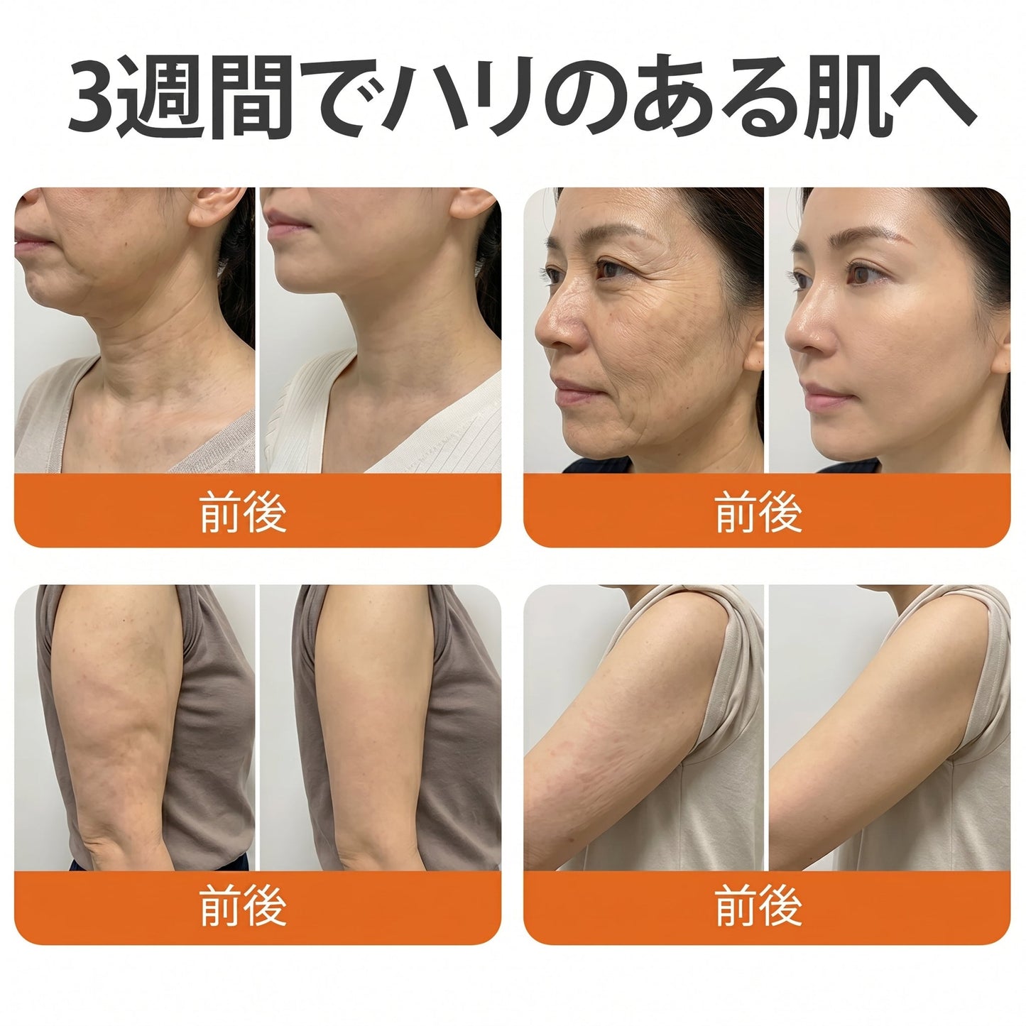 ✨PuraCure® ビーベノム リペア再生クリーム🔥天然由来のエイジングケアで肌を引き締め、ハリを与え、乾燥による小ジワを目立たなくします – 50mL
