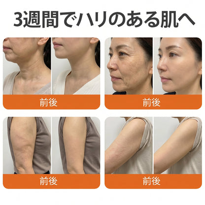 ✨PuraCure® ビーベノム リペア再生クリーム🔥天然由来のエイジングケアで肌を引き締め、ハリを与え、乾燥による小ジワを目立たなくします – 50mL