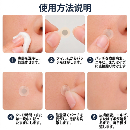 🧑‍⚕️PuraCure® 2-in-1 マイクロニードル＆ハイドロコロイドパッチ🍀| 盛り上がったホクロ・ニキビ・扁平イボ・スキンタッグのケアに | シワ・ニキビ跡・肌の色ムラをケア | 目立たない透明パッチ（顔・体用）